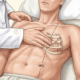 Apex Beat Palpation at the Bedside