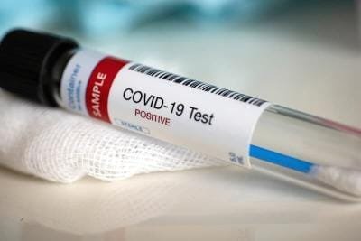 COVID-19 testing in India