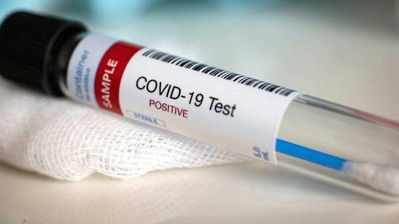 COVID-19 testing in India
