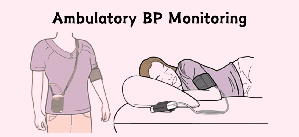 Ambulatory BP Monitoring